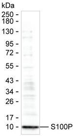 S100P Monoclonal Antibody (K40048_8D5)