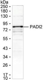 PADI2 Monoclonal Antibody (K40045_12F1)