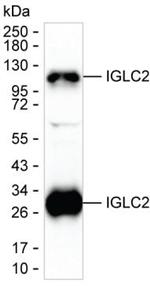 IGLC2 Monoclonal Antibody (K40033_4F3)