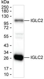 IGLC2 Monoclonal Antibody (K40033_4A4)