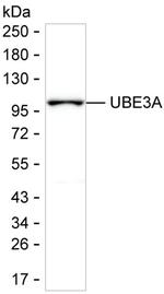 E6AP Monoclonal Antibody (K29054_11H8)