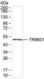 TRIM31 Monoclonal Antibody (K29048_4C6)