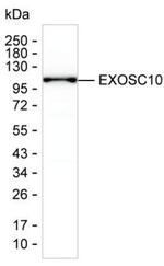 EXOSC10 Monoclonal Antibody (K29029_8C8)