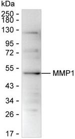 MMP1 Monoclonal Antibody (K29028_18C12)