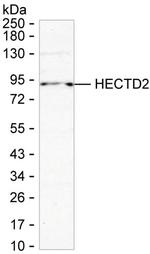 HECTD2 Monoclonal Antibody (K24026_13A9)