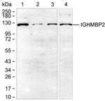 IGHMBP2 Monoclonal Antibody (K24019_8G9)