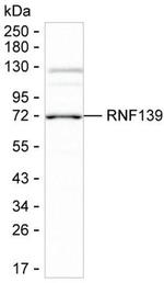 RNF139 Monoclonal Antibody (K1E031_7F8)