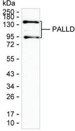 Palladin Monoclonal Antibody (K1E023_7E3)