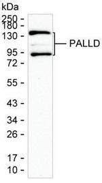 Palladin Monoclonal Antibody (K1E023_15G10)