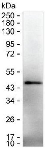 IL-12 p40 Monoclonal Antibody (K1E007_5H5)