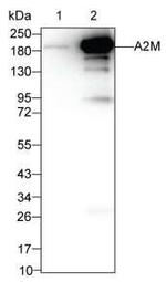 A2M Monoclonal Antibody (K11079_7B1)