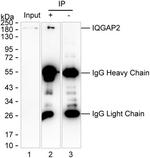IQGAP2 Antibody in Immunoprecipitation (IP)