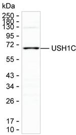 USH1C Monoclonal Antibody (K06328_11D10)