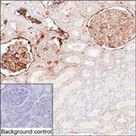 Fibrinogen gamma Monoclonal Antibody (K24024_2E1)