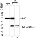 Fibrinogen gamma Antibody in Immunoprecipitation (IP)