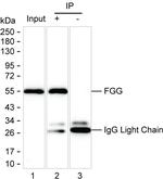 Fibrinogen gamma Antibody in Immunoprecipitation (IP)