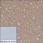 SV2A Monoclonal Antibody (K70011_10H7)