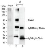 SV2A Antibody in Immunoprecipitation (IP)