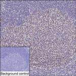 TOP1 Monoclonal Antibody (K94015_6C5)