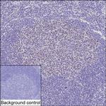 TOP1 Monoclonal Antibody (K94015_12B1)