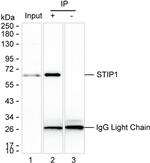 STIP1 Antibody in Immunoprecipitation (IP)