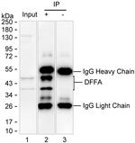 ICAD Antibody in Immunoprecipitation (IP)