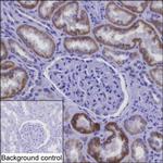 NDUFAF1 Antibody in Immunohistochemistry (Paraffin) (IHC (P))