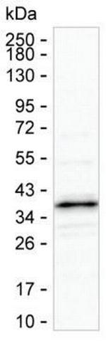 NDUFAF1 Antibody in Western Blot (WB)