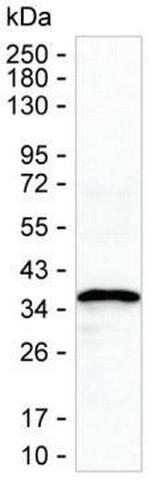 NDUFAF1 Antibody in Western Blot (WB)