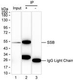 SSB Antibody in Immunoprecipitation (IP)