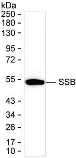 SSB Antibody in Western Blot (WB)