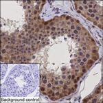 STAMBP Antibody in Immunohistochemistry (Paraffin) (IHC (P))