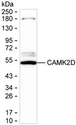 CaMKII delta Antibody in Western Blot (WB)