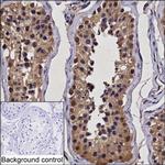 UBE2Z Monoclonal Antibody (K52034_14G2)