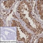 UBE2Z Monoclonal Antibody (K52034_14C7)