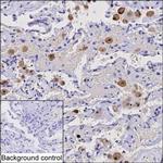 CAPG Monoclonal Antibody (K52030_15B12)