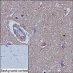 Ankyrin B Monoclonal Antibody (K52014_1E12)