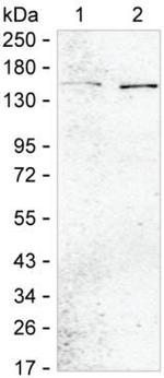 Ankyrin B Antibody in Western Blot (WB)