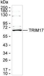 TRIM17 Antibody in Western Blot (WB)
