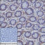 CHOP Monoclonal Antibody (K49008_20C12)