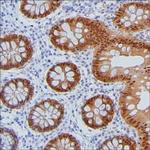 PPP1R14D Monoclonal Antibody (K49008_16C7)