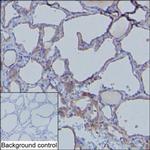 MDA5 Monoclonal Antibody (K49007_11D6)