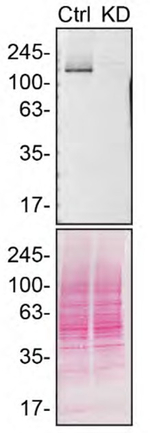 MDA5 Antibody in Western Blot (WB)