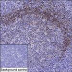 TCL1A Monoclonal Antibody (K40047_8H9)