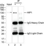 HIP1 Antibody in Immunoprecipitation (IP)