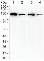 HIP1 Antibody in Western Blot (WB)
