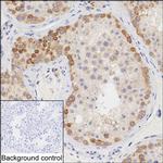 HERC5 Monoclonal Antibody (K29053_10C7)