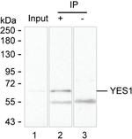 YES1 Antibody in Immunoprecipitation (IP)