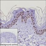 EXOSC10 Monoclonal Antibody (K29029_1D2)