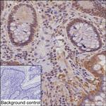 NYREN18 Monoclonal Antibody (K24024_14E2)